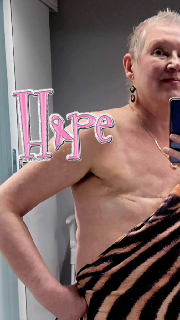 Hope O.H